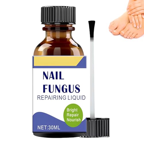 1 Piezas Hongos uñas pies,Tratamiento Uñas Pies, Reparadores de Uñas Solución, Cuidado Uñas Dañadas, Fortalece la Uña, La Uña se Regenera de Forma Natural, 30ml,A