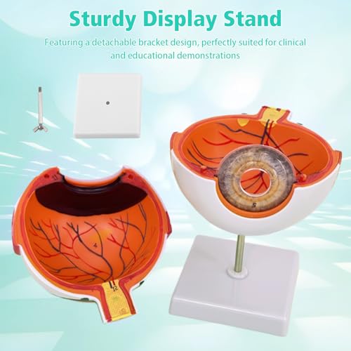 Gevvnss Augenanatomie-Modell, 6-fach vergrößertes Augapfel-Modell, menschliches Auge-Modell mit abnehmbarer Basis, für Anatomiestudium, Unterricht