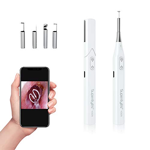 Ear Wax Removal Otoscope Curette Compatible with iPhone & Android – HD Ear Camera with 4 Adjustable LED Lights for Kids, Adults & Pets