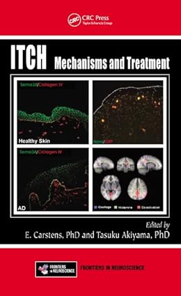 Itch: Mechanisms And Treatment (Hb 2014)