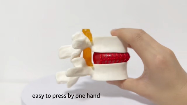 Image of Herniated Disc Spine Model, 1.5X Life Size Lumbar Spine Anatomy Model for Teaching, Chiropractic Demonstration, Medical Learning and Patient Education (1pc Spine and Disc Model)