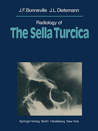 Radiology of The Sella Turcica (English Edition)