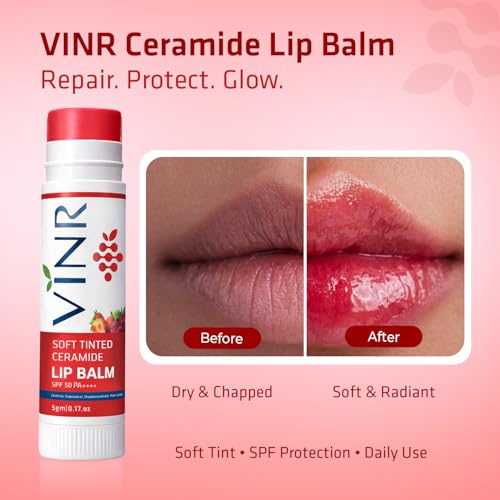 Image of VINR Tinted Lip Balm for Pigmented Lips SPF 50 PA+++ | Kojic Acid, Niacinamide & Ceramide Lip Care | Strawberry Lip Balm for Dry & Damaged Lips (5g Pack of 1)