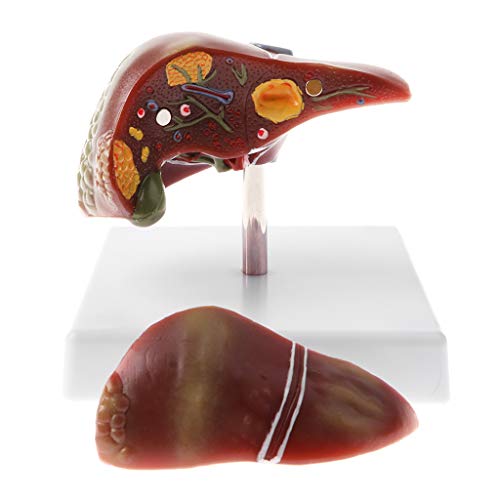 Human Diseased Liver Model, Lab Equipment