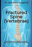 Comprehensive Treatise on Fractured Spine (Vertebrae): From Diagnosis to Recovery B0D5QKJNVN Book Cover