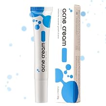 Azelaic Acid Acne Cream for Face,Azelaic Acid With Hyaluronic Acids for Face Redness Smooth, Anti Acne Breakouts Azelaic Acid Serum Balance Excess Oil & Soothing No Irritation