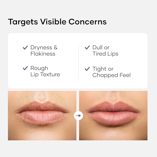 Image of Cureskin Lip Deep Therapy Lip Mask | Moisturizing Lip Treatment with Vitamin C + Shea Butter for Soft Hydrated Lips | Overnight Repair | Lip Balm For Dry Chapped Lips | Lasting Hydration, 10 g (Pack of 1)