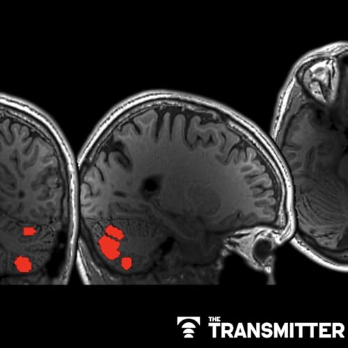 Cerebellum responds to language like cortical areas