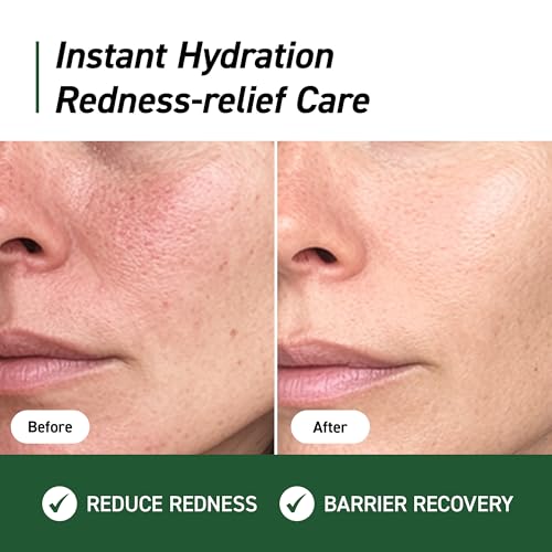 Image of IVOSKIN Cica Redness Relief Treatment Cream, Soothing & Hydrating Green Correcting Moisturizer with Madecassoside, Helps Repair Skin Barrier for Sensitive Skin, Vegan, Korean Skincare (1.76oz / 50g)