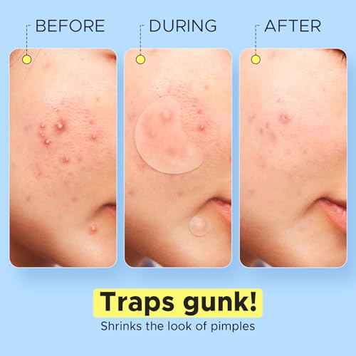 50% Off LitBear Pimple Patches with Code D9LUYWB2 - Image 7