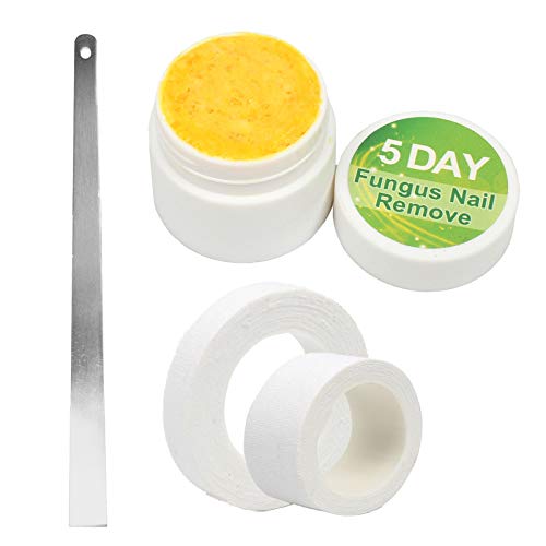 20g de Tratamento de Fungo de Unha de Dedo Do Pé Ferramenta de Solução de Cuidados para Reparos de E