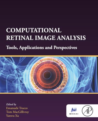 Computational Retinal Image Analysis: Tools, Applications and Perspectives (The MICCAI Society book Series)