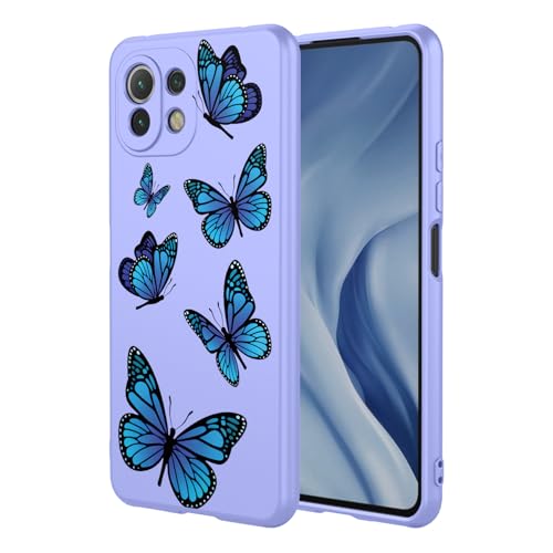 Coque Xiaomi 11 Lite antichoc pour éviter les rayures