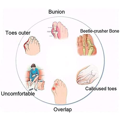 Vintage Bunion Corrector Mens Sandals,Elegant PU Lightweight Non-Slip Orthopedic Beach Slippers,Summer Travel Hallux Valgus Walking Flip Flops,for Plantar Fasciitis4