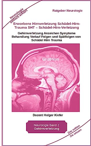 Erworbene Hirnverletzung Schädel-Hirn-Trauma SHT – Schädel-Hirn-Verletzung - Rehabilitation - für Patienten, Angehörige, medizinisches Personal: ... Hirn Trauma - Neurologie einfach erklärt