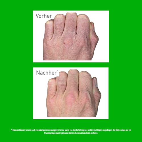 O'Keeffe's Working Hands Tube, 80 ml – Handcreme für extrem trockene, rissige Hände | Spendet sofort Feuchtigkeit, bildet eine Schutzschicht und verhindert Feuchtigkeitsverlust