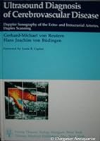 Ultrasound diagnosis of cerebrovascular disease: Doppler sonography of the extra- and intracranial arteries duplex scanning 3137844010 Book Cover