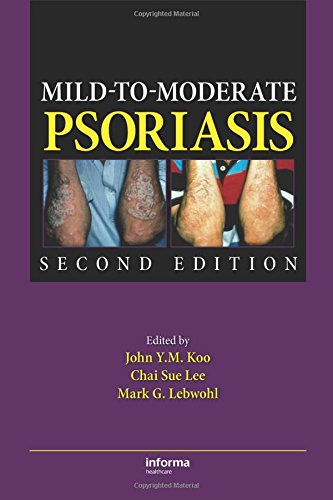Mild-to-Moderate Psoriasis, Second Edition