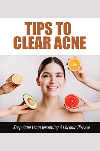 Tips To Clear Acne: Keep Acne From Becoming A Chronic Disease (English Edition)