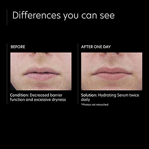 Pca Skin Hydrating Face Serum - Soothing Anti Aging Facial Treatment With Hyaluronic Acid Sodium And Aloe Vera To Boost Moisture & Minimizes Fine Lines & Wrinkles (1 Fl Oz) #TOP3