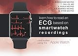  Learn how to read an ECG based on smartwatch recordings: clinical cases from the Apple Watch