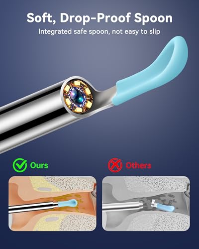 image for Jegoat Ear Wax Removal, 1080P HD Scope and 6 LED Lights, Ear Cleaner w