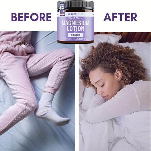 Image of Magnum Solace Nighttime Magnesium Lotion with Arnica - Highly Concentrated Magnesium for Muscles & Joints - Apply to Legs or Feet Before Bed - Skin-Friendly (Pack of 3)
