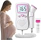 Ultraschall-Gel für Schwangerschafts-Doppler – Baby-Herzfrequenzmonitor Zubehör,ZLK513