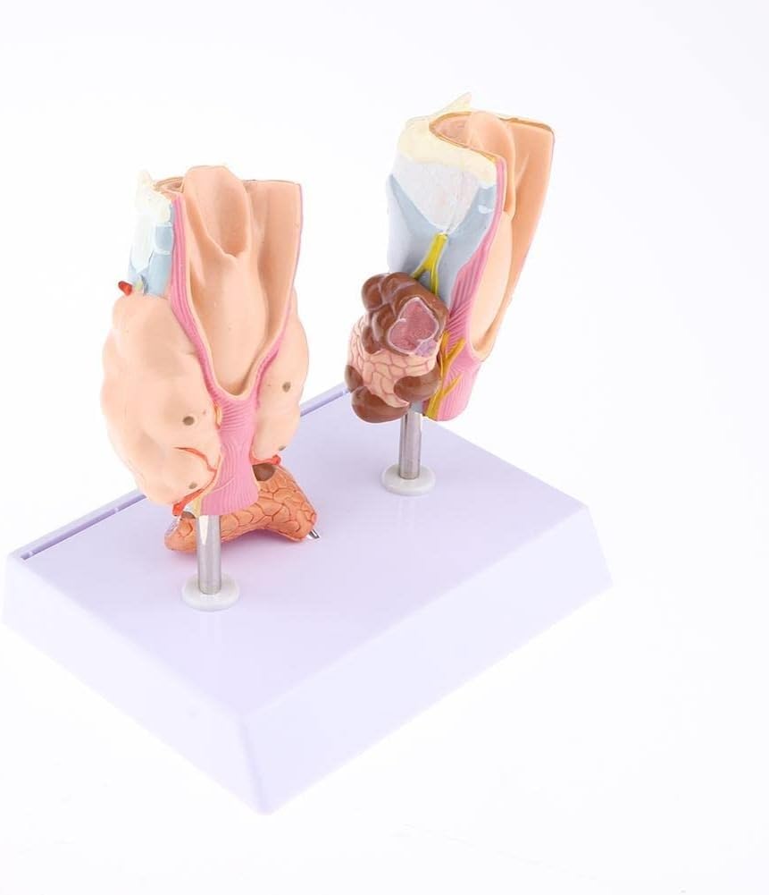 Model anatomiczny tarczycy, model torbieli guza gardła, modele anatomiczne normalne i chore z patologiami Medyczne pomoce dydaktyczne, demonstracje nauczania medycznego.