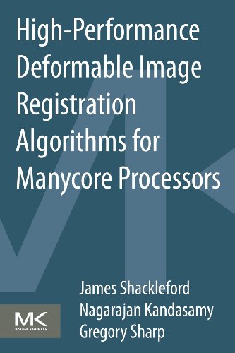 High-Performance Deformable Image Registration Algorithms for Manycore Processors view 2