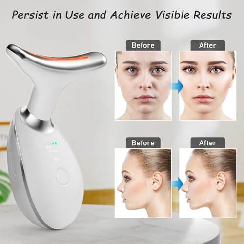 Jinstyles Neck and Face Skin Care Tool, Improve, Firm, Tightening and Smooth, White - Image 6