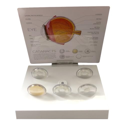 Modèle d'anatomie oculaire pour simplifier les cas cliniques complexes - 5