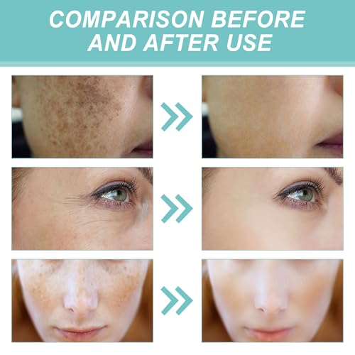 Labello Dark Spot Remover For Face, Dark Spot Serum For Sun Spots thumb #4