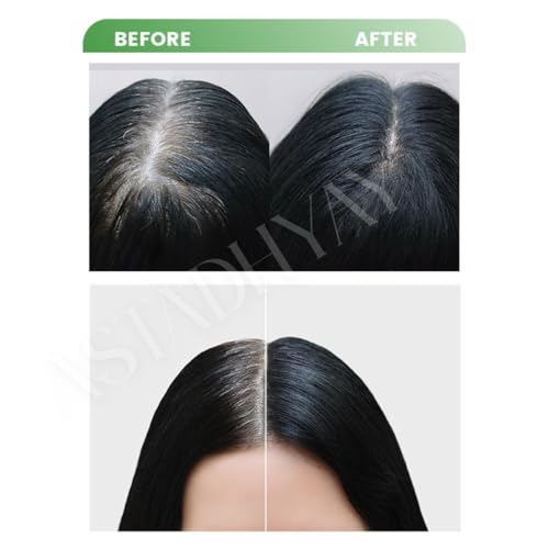 Image of Fruit Vinegar Gel Hair Color For Men & Women, Hair Color Dye for Black Hair (Black, 400ml (100ml x 4))