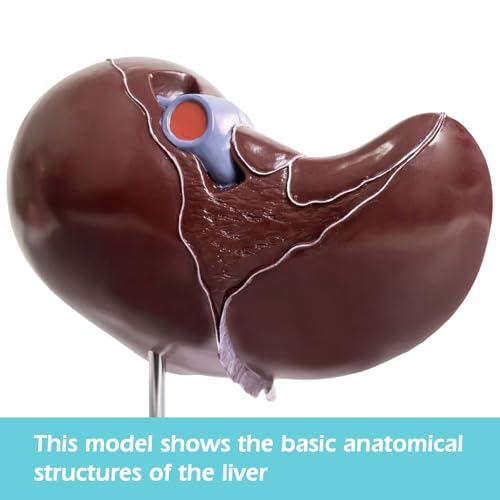 Image of EVOTECH SCIENTIFIC Deluxe Human Liver Anatomical Model, 2 Parts 1.5X Enlarged Human Liver Anatomical Model for Medical Teaching Learning Research Education Display