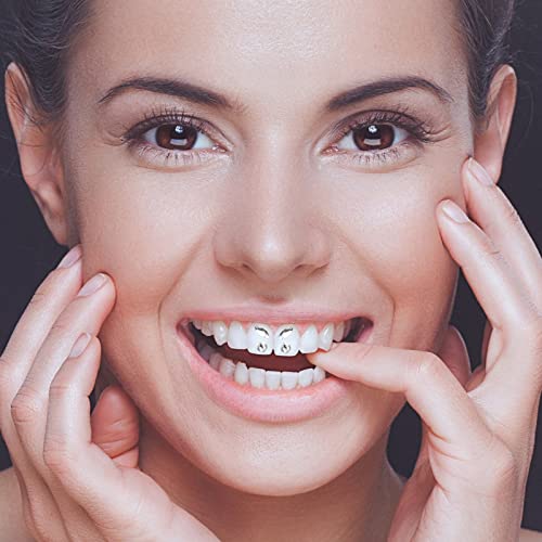 Zahnkristall, Zahnstein Zahnverzierungen 4pcs/Box Zähne Edelstein Schönheit Dental Diamant Zahn Ornamente Schmuck Dekoration Kristall Edelstein Strass Dekor