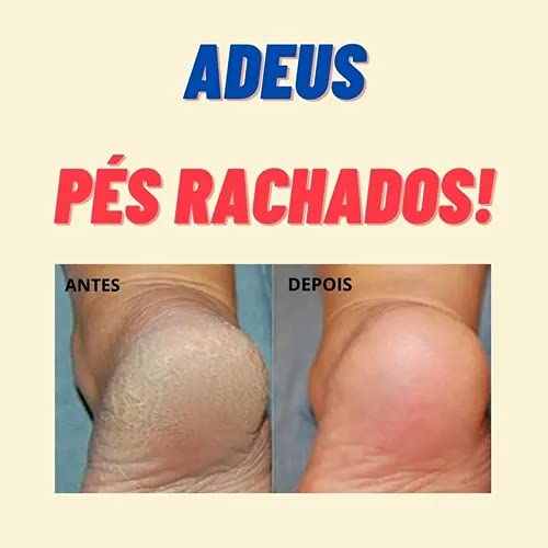Repos Amaciante de Cutículas e Calosidade 120ml+Creme Removedor de Cutícula 120g+Creme Para Mãos e P