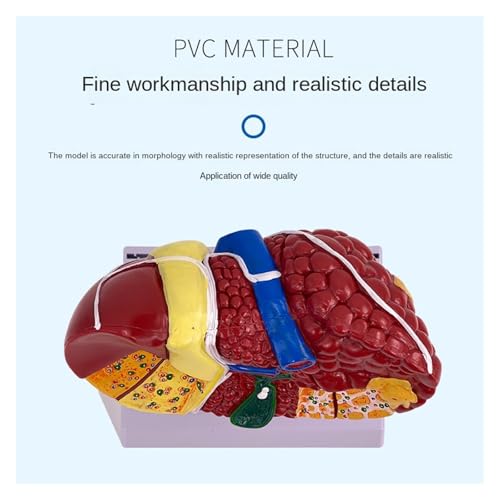 Modelo de hígado de anatomía patológica con textura clara y piezas desmontables 4