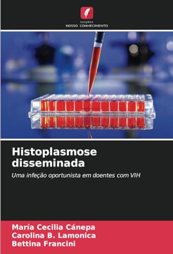 Histoplasmose disseminada: Uma infeção oportunista em doentes com VIH