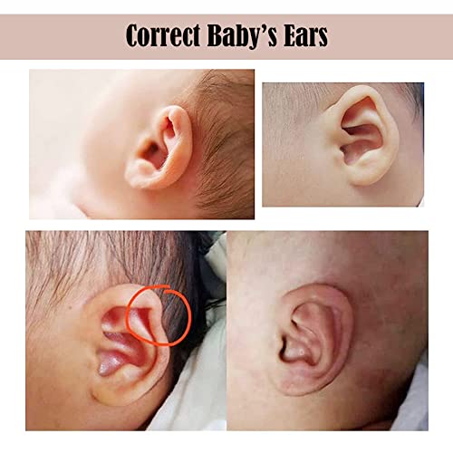 Vendaje corrector de oído Baby Auricle, corrección de orejas Parche valgo oreja bebé estético para salientes Correctores silicona para recién nacidos Parches sobresalientes Pegatinas