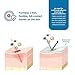 Stratamed Advanced Film-Forming Wound Dressing | Forms a Flexible Protective Layer Over Open Wounds & Damaged Skin | for Faster Healing and Early Abnormal Scar Management | 5g (0.17oz)