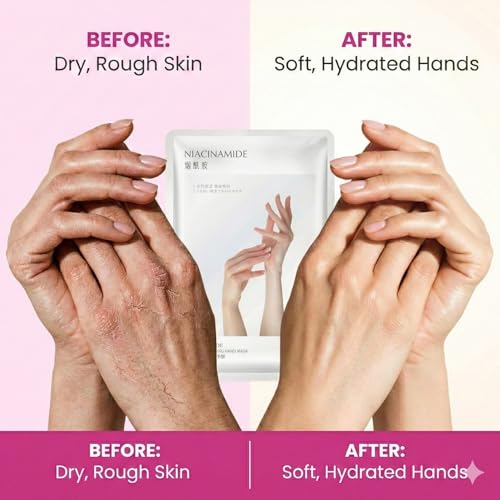 5Packs Hand Mask with Niacinamide, Deep Hydration Hand Mask Gloves for Dry Cracked Hands, Moisturizing Hand Moisturiser Gloves with Shea Butter & Vitamin E, Skin Care Gifts for Women & Men - Image 3