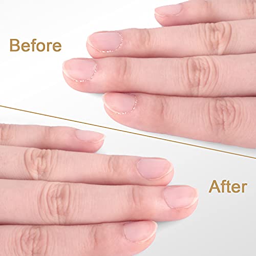 Cuticle Trimmer With Cuticle Pusher - Easkep Cuticle Remover Cuticle Nipper Professional Stainless Steel Cuticle Cutter Clipper Pedicure Manicure Tools For Fingernails And Toenails (D501-Silver) #TOP5