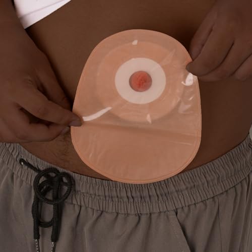 Image of Sticky Ileostomy Simulators, Stoma Training Model Set, Multi-Skin Tone Ostomy Care Practice Models for Medical Training and Patient Education - Dark