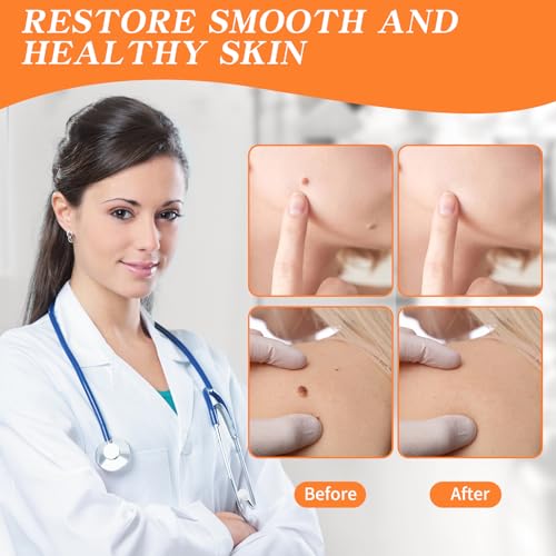 Image of Bighero 2 Pack Wart Fast Acting Gel Wart Remover Freeze Off Ointment,Wartes Cream for Genital Wartss, Warts, Plantar Warts, Common Wartes, Corn, Flat Wars NDC (84010-047-02)