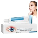 Ch/alazion and Ble/pharitis Treatment Eye Cream,Stye Eye Treatment,Ch/alazion Remover, for Ble/pharitis,Relieve Eyelids Itchy,Dry Eye Treatment for Hydrate