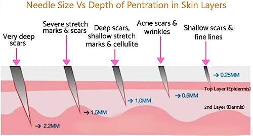 Ymenglei-Microneedle-Tberapy-System-540-Needles-100mm-Model-NrMT10-Skin-Roller-Skin-Rejuvenation-Anti-Ageing-Scar-Acne-marks-Cellulite-Treatment-Black