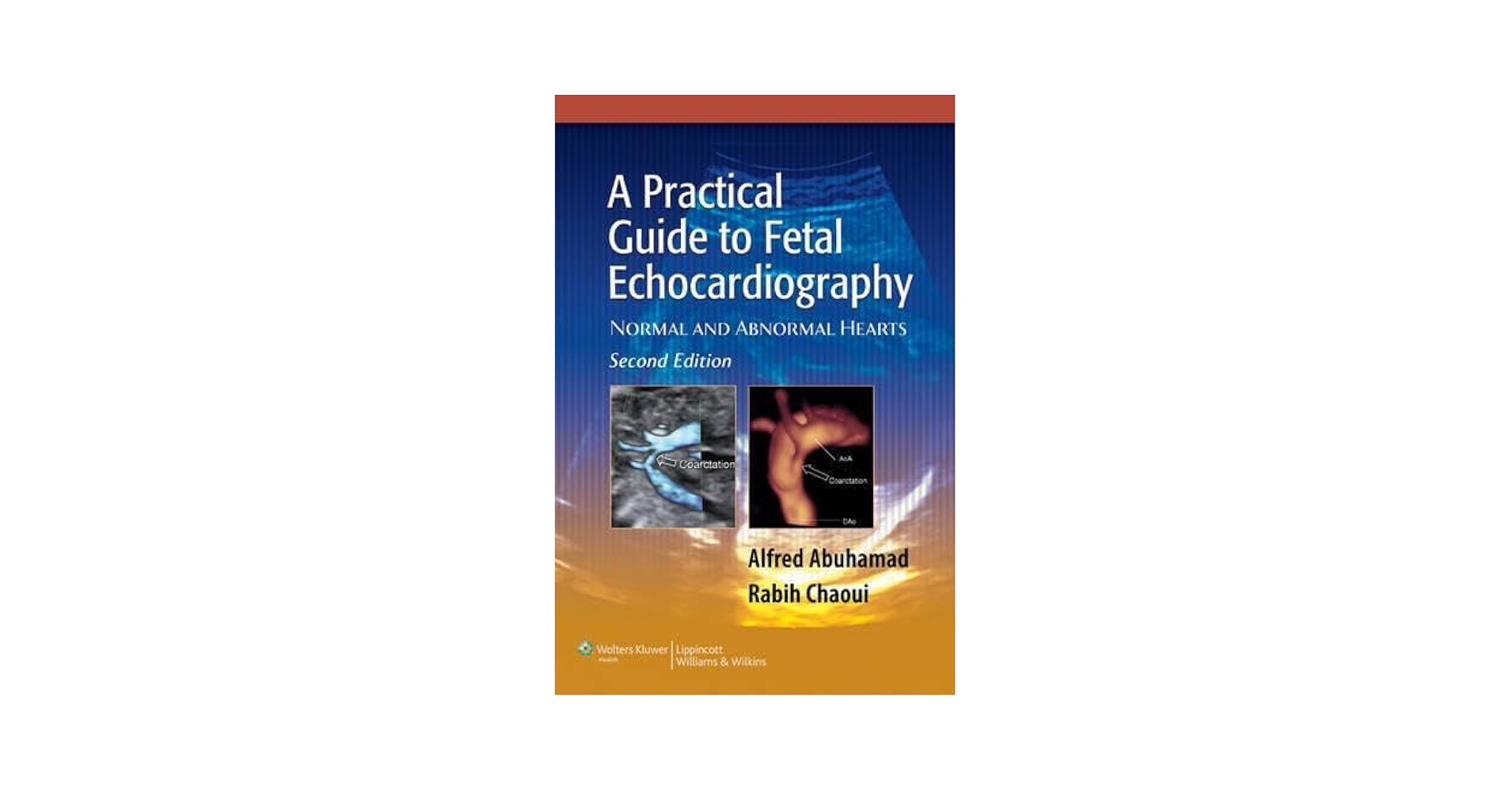 健康・医学 A Practical Guide to Fetal A Practical Guide to Fetal Echocardiography: Normal and