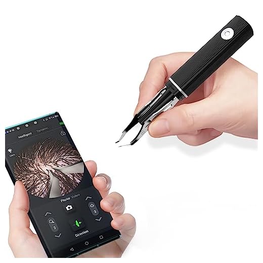 Hair Removal Tweezer with 1080p Camera, Ultimate Precision: Tweezer with Camera - Perfect for Delicate Tasks! - - Ear Hair Eyebrow Tweezer