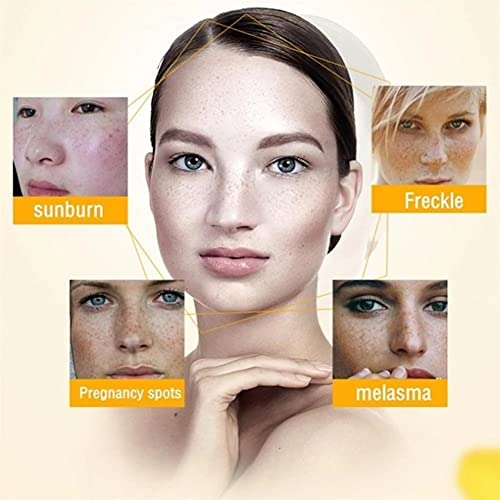 2PCS Spot-Off Freckle Whitening Cream,Crema